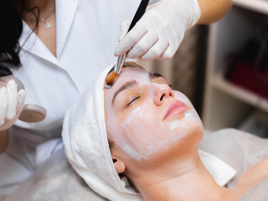 Chemical Peel