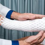 purpose of compression bandage