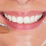 best cosmetic dentist in houston tx