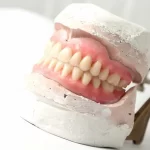 dentures in houston