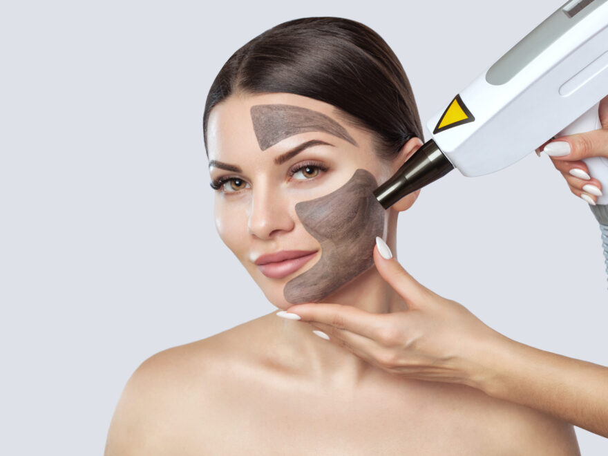 laser treatment in Lahore