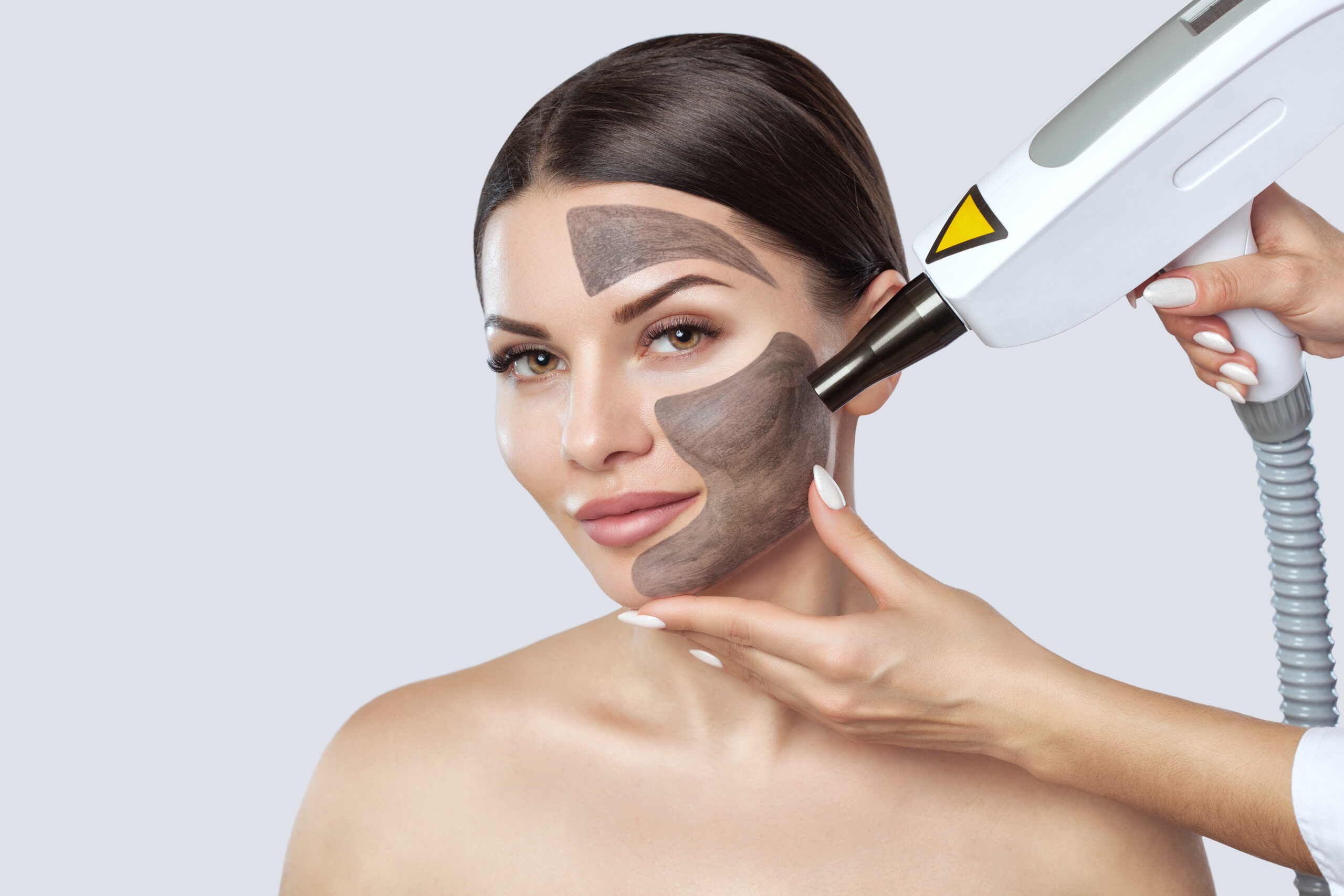 laser treatment in Lahore