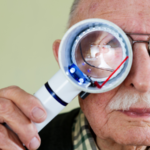 Age-Related Macular Degeneration Market Size and Growth Forecast 2024-2032