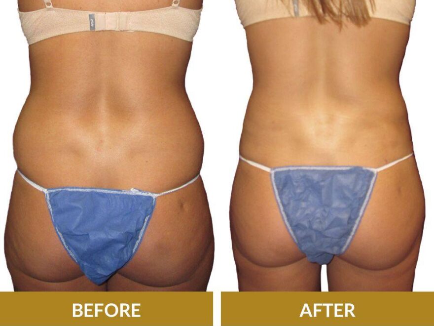 Cosmetic Surgery Houston