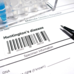 Huntington’s Disease Treatment Market Size and Growth Forecast 2024-2032