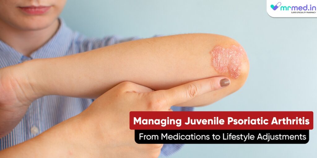 Managing Juvenile Psoriatic Arthritis: From Medications to Lifestyle Adjustments