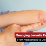 Managing Juvenile Psoriatic Arthritis: From Medications to Lifestyle Adjustments