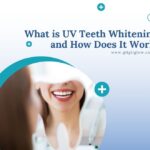 UV Teeth Whitening