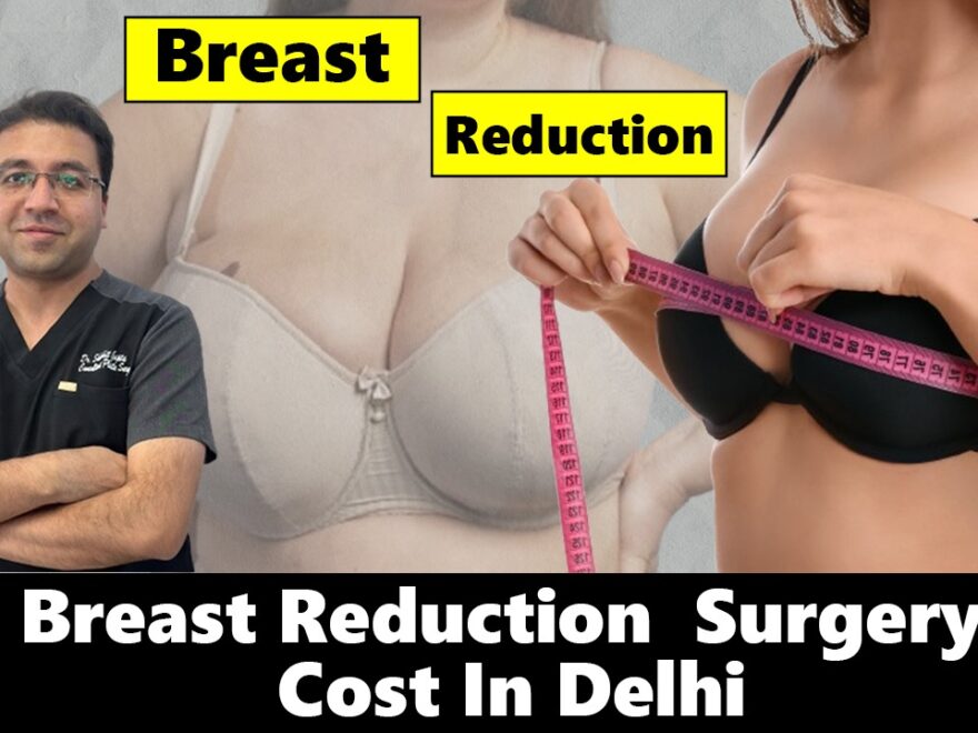 breast lift surgery in delhi