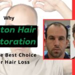 Why-Boston-Hair-Restoration-is-the-Best-Choice-for-Hair-Loss