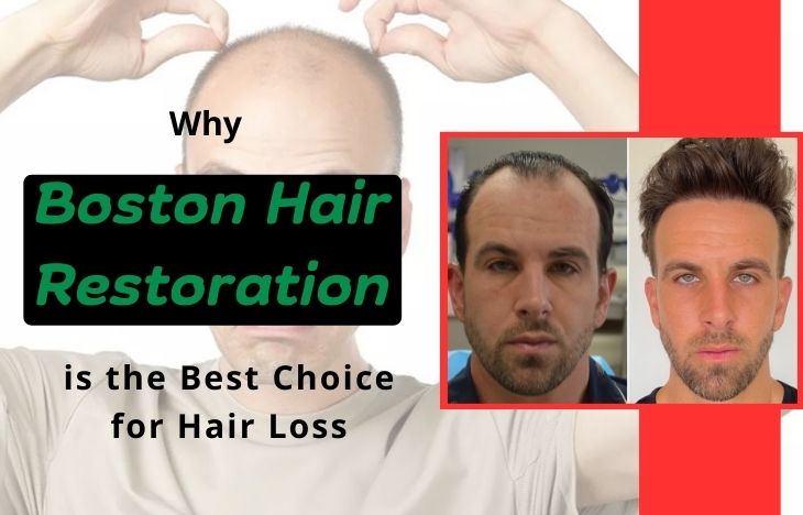 Why-Boston-Hair-Restoration-is-the-Best-Choice-for-Hair-Loss