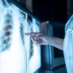 X-Ray Safety: Minimizing Exposure to Radiation