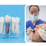 Braces dentist jaipur