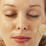 chemical peel treatment in Pakistan