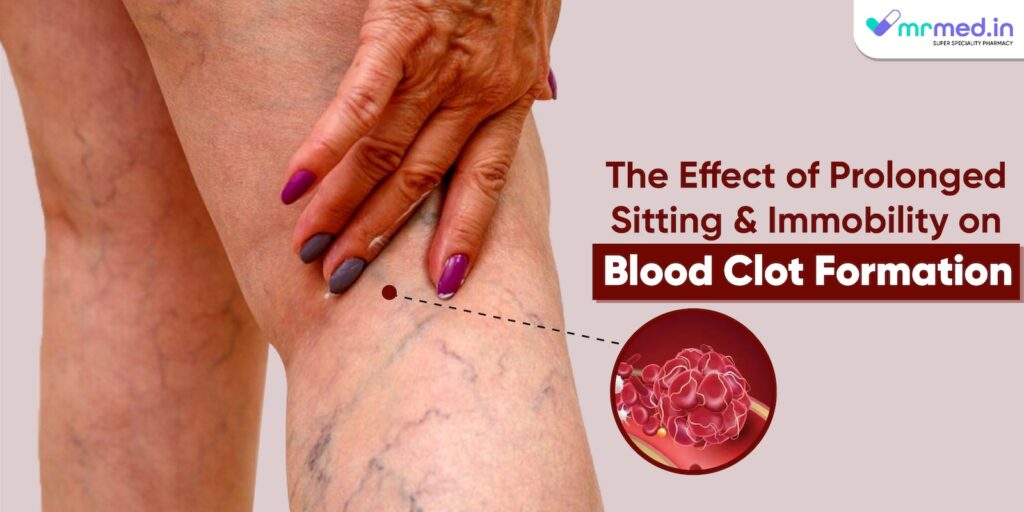 The Effect of Prolonged Sitting and Immobility on Blood Clot Formation