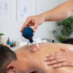 cupping therapy in Adelaide