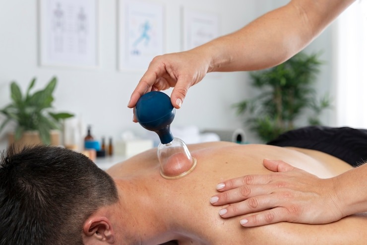 cupping therapy in Adelaide