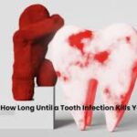 Tooth Infection to Life Threat What You Need to Know About the Serious Risks