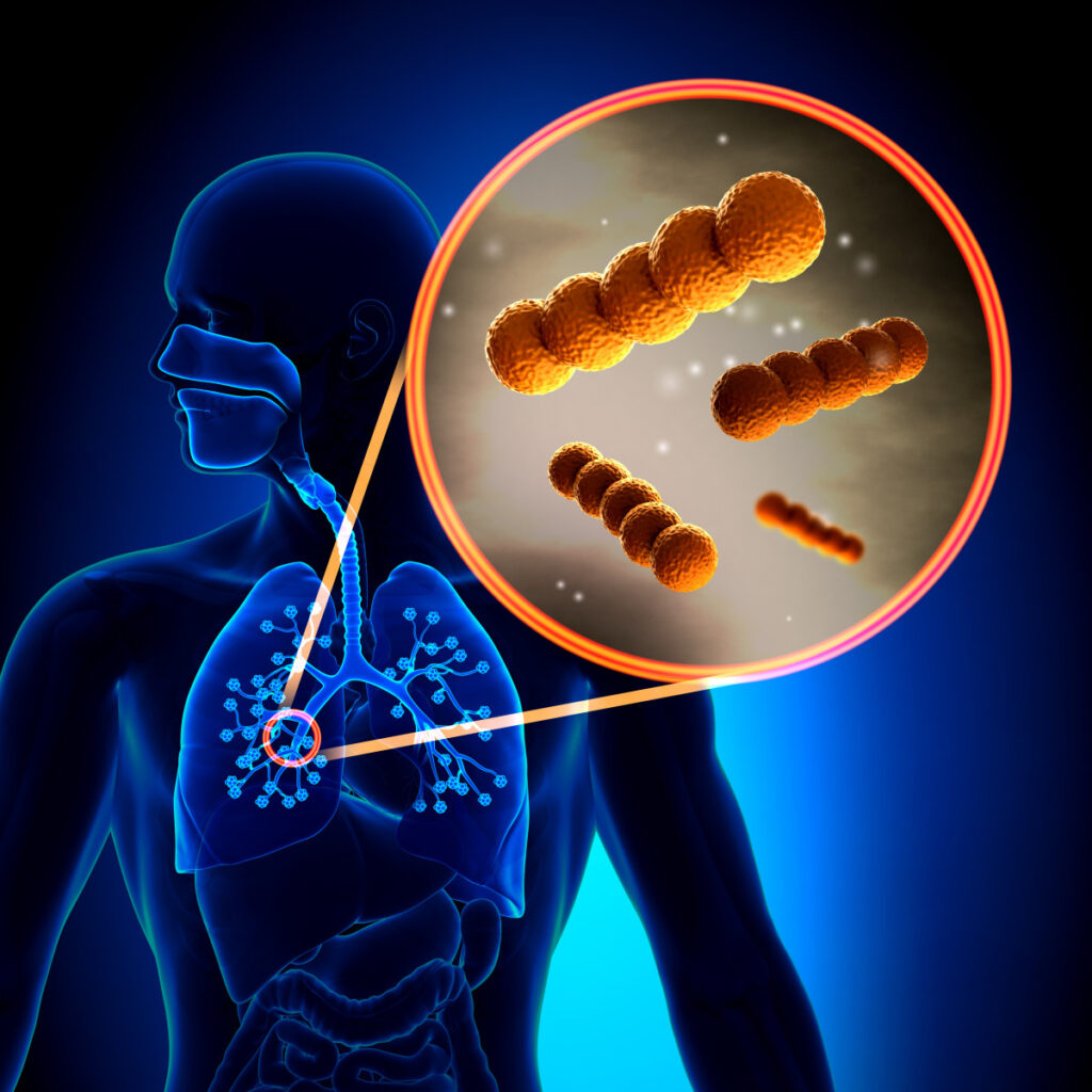 Amoxicillin against Other Antibiotics: A Comparison of Their Safety and Effectiveness