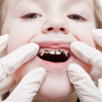 Beyond the Smile: Recognizing the Dangerous Health Effects of Skipping Dental Care