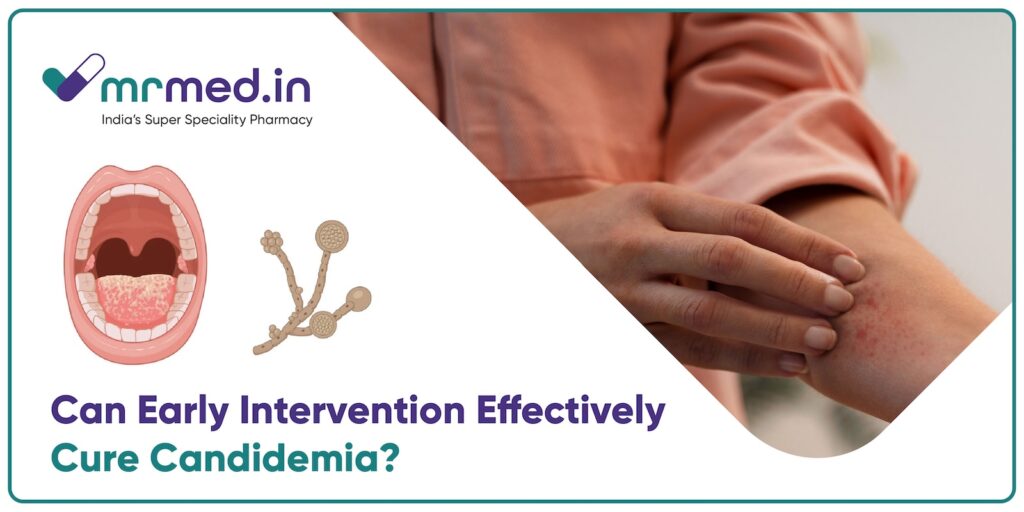 The Role of Early Intervention in Improving Candidemia Treatment Outcomes