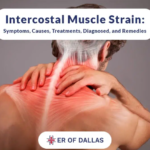 intercostal muscle strain