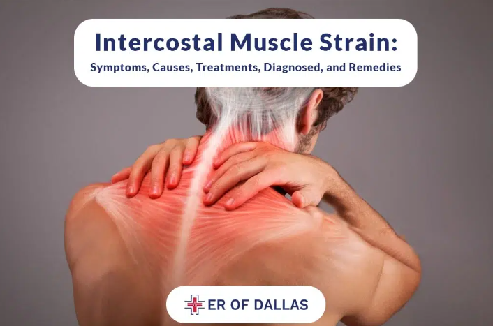 intercostal muscle strain