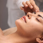 Cosmetic Acupuncture near Me