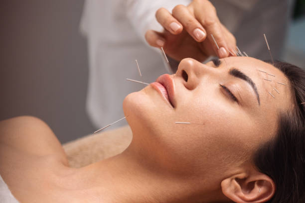 Cosmetic Acupuncture near Me