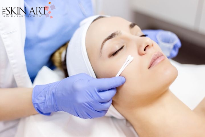 Chemical Peel Treatment in Lucknow