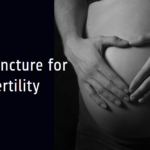 acupuncture for fertility