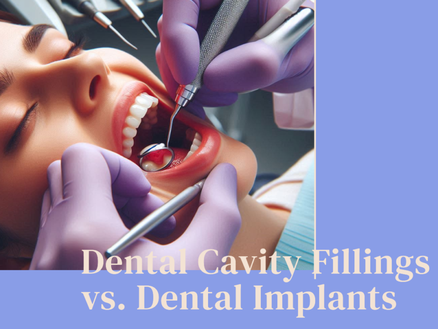 Cavity Filling and Veneers Cost in NYC: Insights into Dental Treatment Pricing