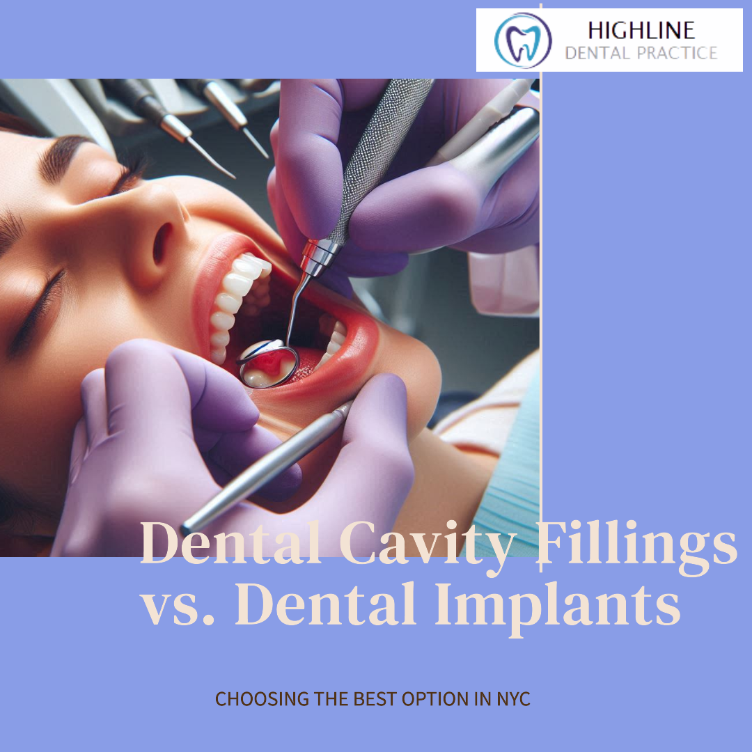 Cavity Filling and Veneers Cost in NYC: Insights into Dental Treatment Pricing