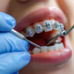 Choosing The Right Houston Dentist For Your Family’s Oral Health Needs