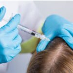 Mesotherapy in Istanbul