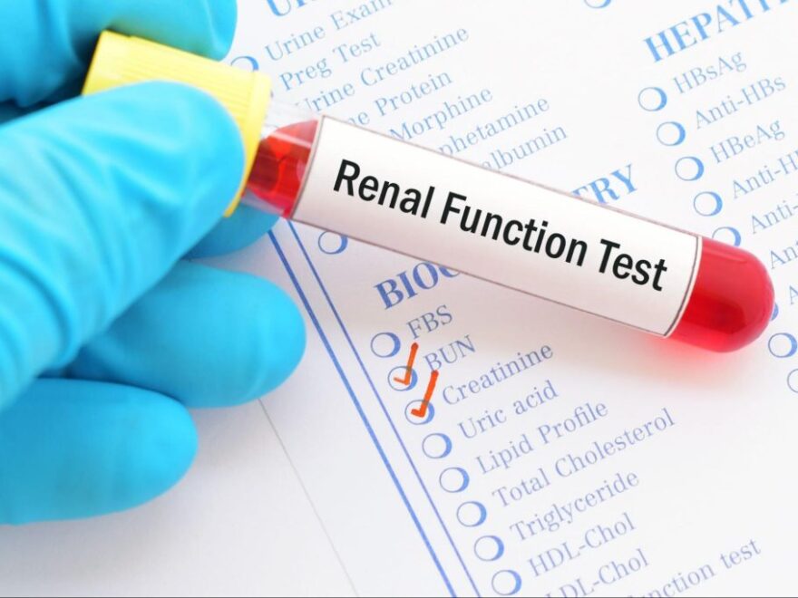 Kidneys Function test