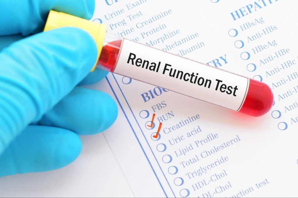 Kidneys Function test