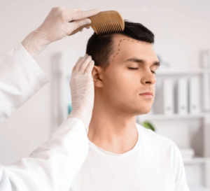 best hair transplant clinic london