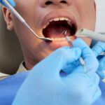 Is Root Canal Treatment in Wallan Painful?