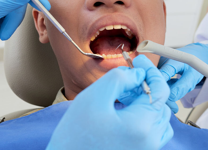 Is Root Canal Treatment in Wallan Painful?