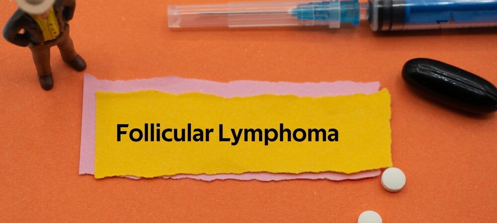 symptoms of follicular lymphoma