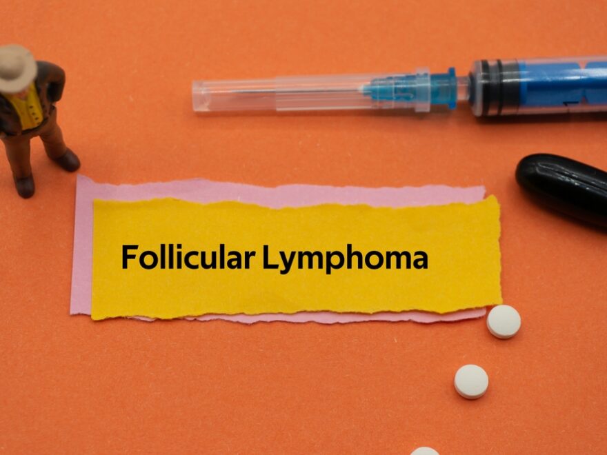 symptoms of follicular lymphoma