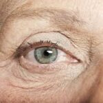 Age-Related Macular Degeneration Market Analysis And Growth Forecast 2024-2032