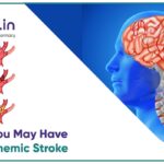 Common Warning Signs Of An Acute Ischemic Stroke You Should Never Ignore