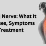 pinched nerve treatment