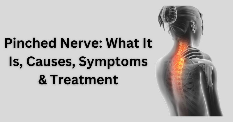 pinched nerve treatment