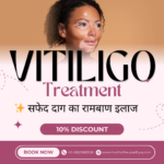 Best dermatologists in India for vitiligo treatment