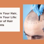 Transform Your Hair, Transform Your Life: The Power of Hair Transplants