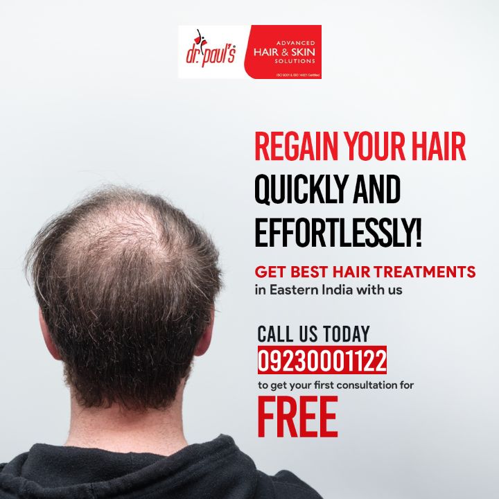 hair transplant in Kolkata