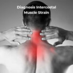 intercostal muscle strain